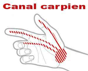 canal carpien