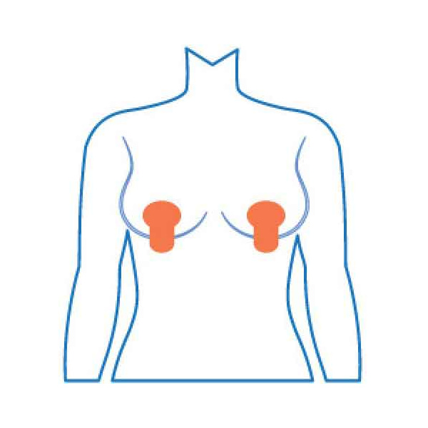mammopatch-vertical-croquis