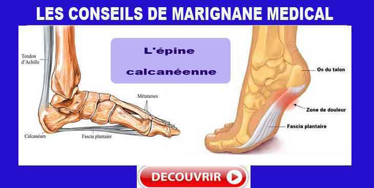 epine calcaneenne